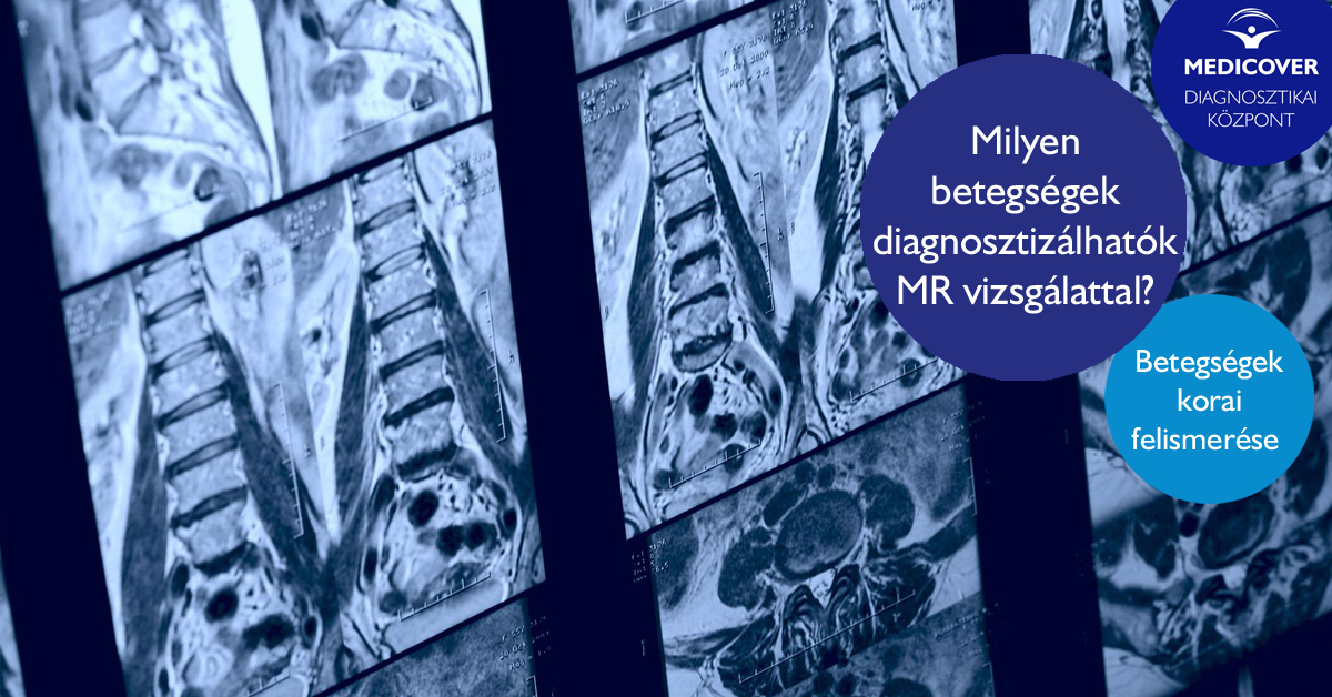 az ízületi betegségek mr diagnosztizálása hatékony gyógyszer a nyaki osteochondrozisra
